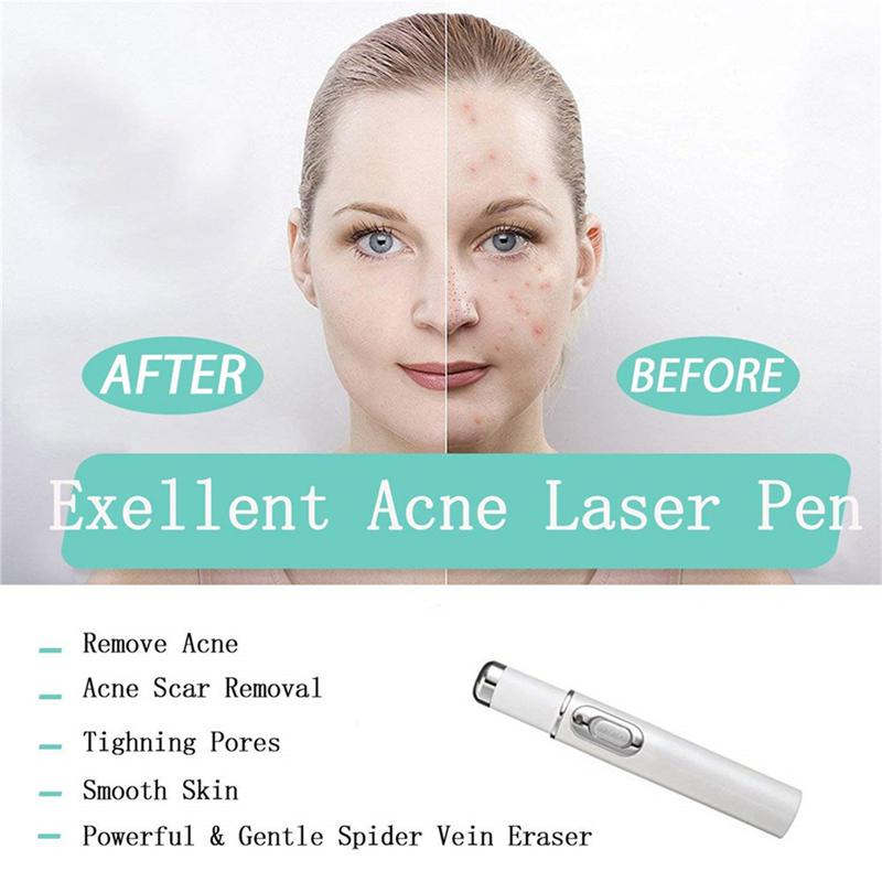 Heath-Blue-Light-Therapy-Varicose-Veins-Treatment-Laser-Pen-Soft-Scar-Wrinkle-Removal-Treatment-Acne-Laser (3)