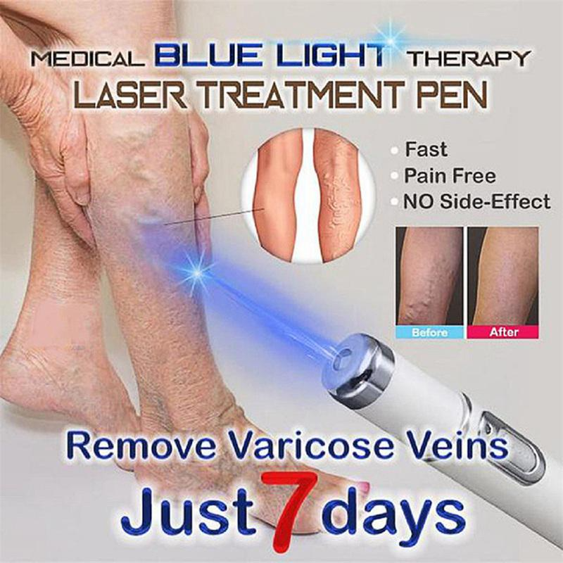 Hot-Heath-Blue-Light-Therapy-Varicose-Veins-Treatment-Laser-Pen-Soft-Scar-Wrinkle-Removal-Treatment-Acne